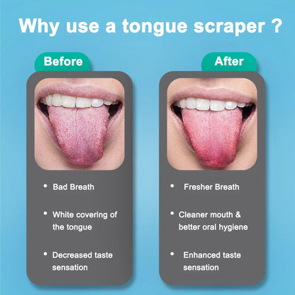 Tongue Cleaner
