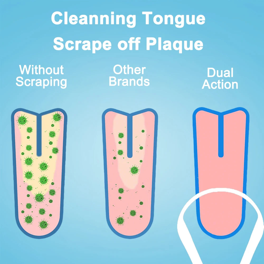 Tongue Cleaner